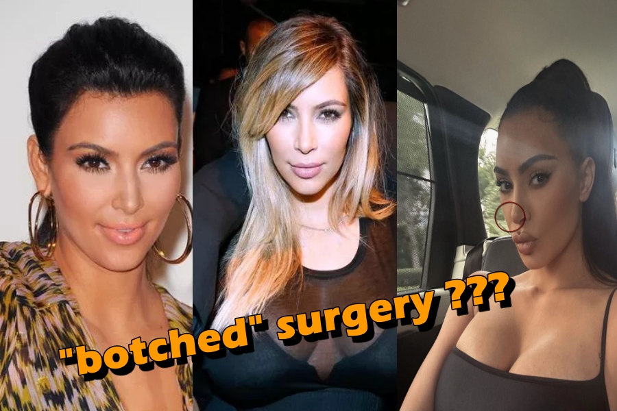 Inside Kim Kardashians Changing Face As Fans Spot Collapsed Nostril